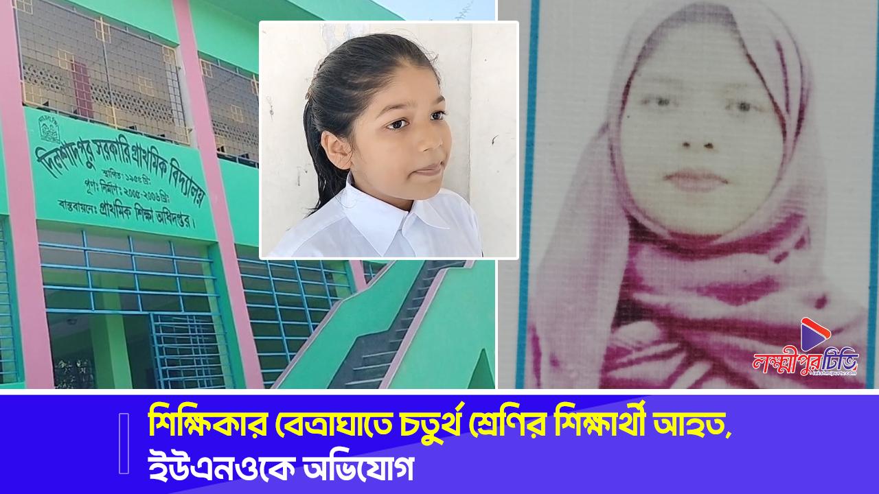 শিক্ষিকার বেত্রাঘাতে চতুর্থ শ্রেণির শিক্ষার্থী আহত, ইউএনওকে অভিযোগ